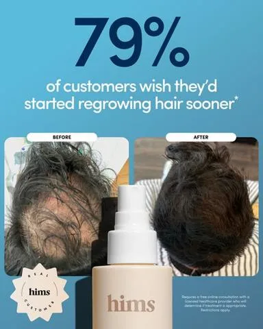 Hims advertisement