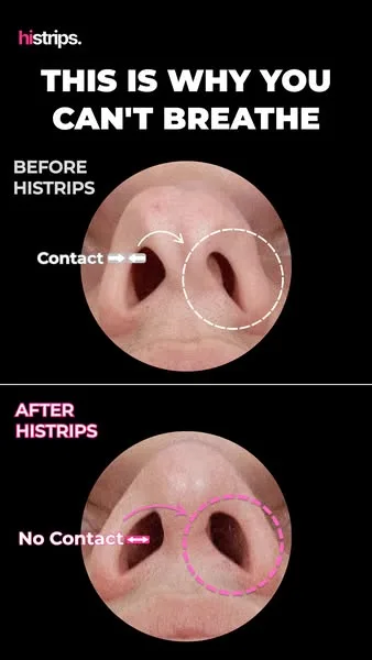 HiStrips advertisement
