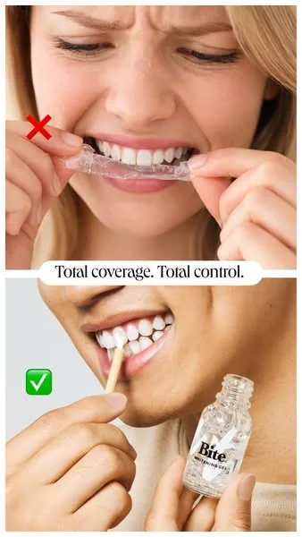 Bite advertisement
